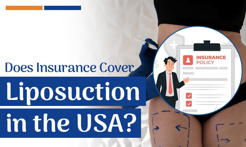 Does Insurance Cover Liposuction in the USA?